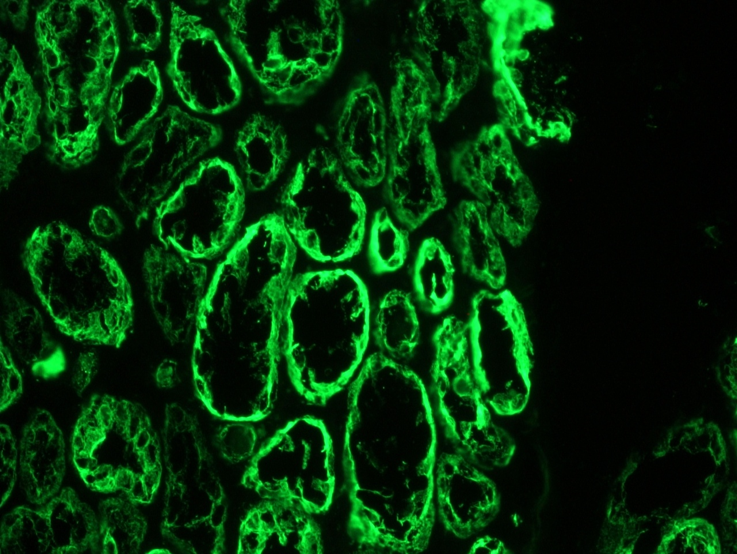 Figure 2. Indirect immunofluorescence staining of frozen section of human kidney with MUB0327P (RCK106) showing positive staining in epithelial compartment. Dilution 1:500.